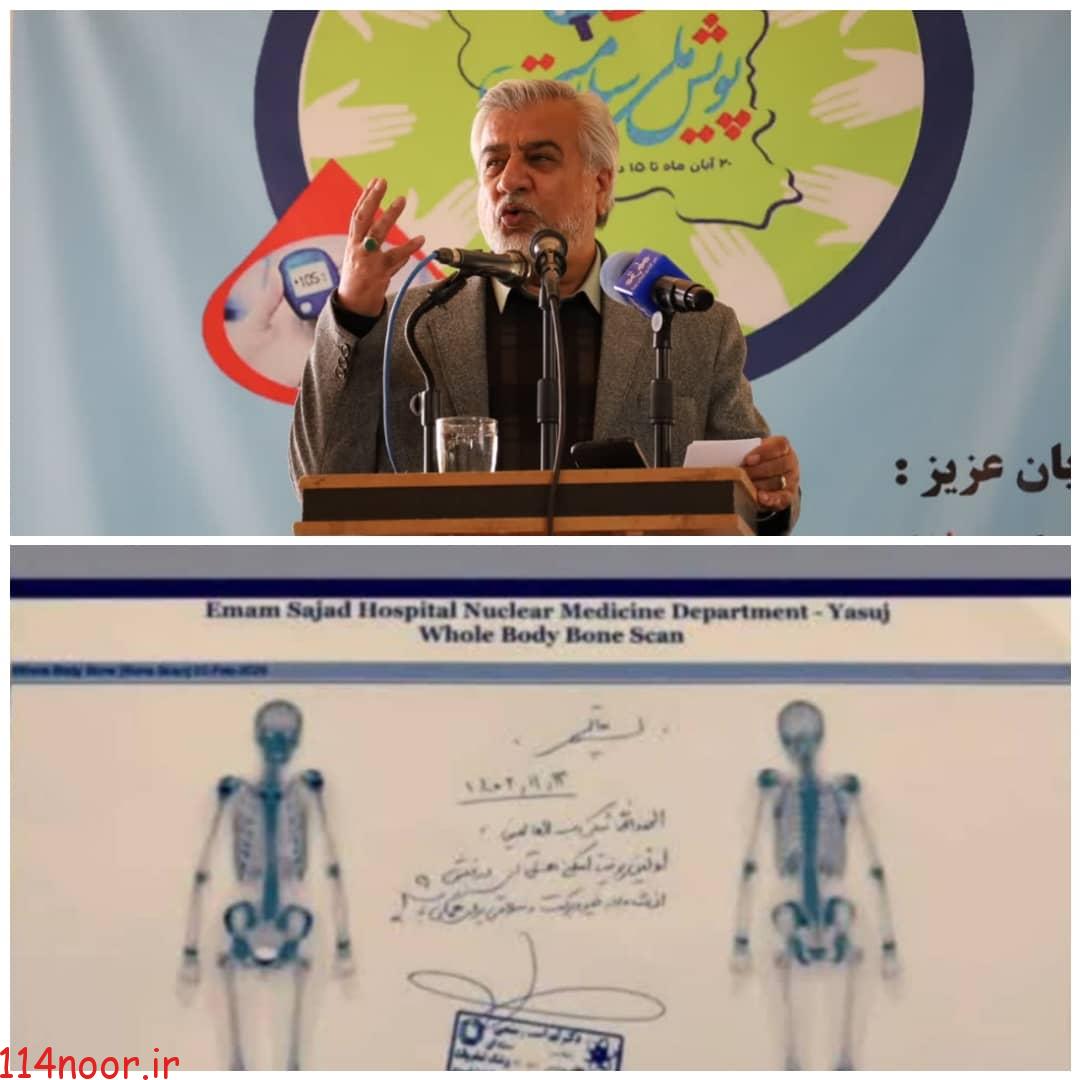 برای نخستین بار در استان: انجام اسکن تمام بدن استخوان با تزریق داروی پرتوزا برای اولین بار در در مرکز پزشکی هسته ای یاسوج/ دکتر رستمی: مرکز پزشکی هسته ای در دو شیفت صبح و عصر فعال است